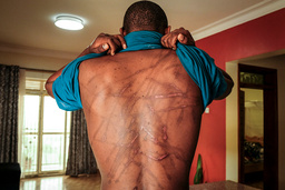 Kakwenza Rukirabashaija visar ärren efter den tortyr som han utsattes för i Kampala, Uganda. Arkivbild.